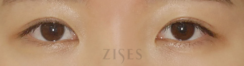 ���� ���� ����