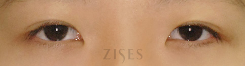 ���� ���� ����