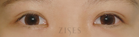 ���� ���� ����