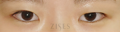 ���� ���� ����