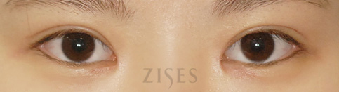 ���� ���� ����