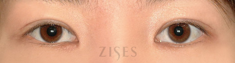 ���� ���� ����