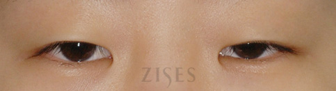 ���� ���� ����