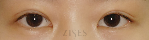 ���� ���� ����