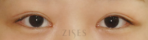 ���� ���� ����