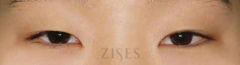 ���� ���� ����