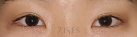 ���� ���� ����