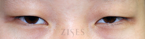 ���� ���� ����