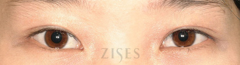 ���� ���� ����