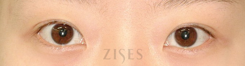 ���� ���� ����