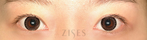 ���� ���� ����