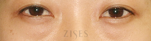 ���� ���� ����