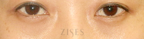 ���� ���� ����