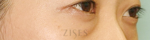 ���� ���� ����