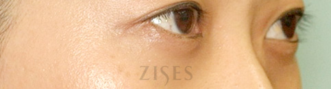 ���� ���� ����