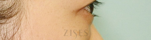 ���� ���� ����