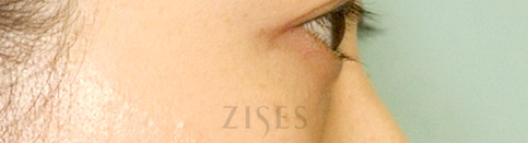 ���� ���� ����