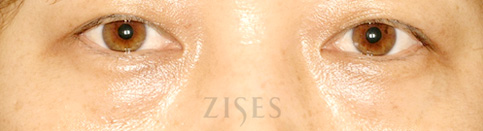 ���� ���� ����