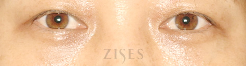 ���� ���� ����