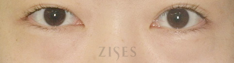 ���� ���� ����