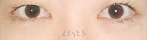 ���� ���� ����