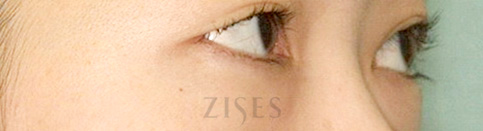 ���� ���� ����