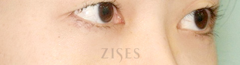 ���� ���� ����