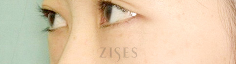 ���� ���� ����