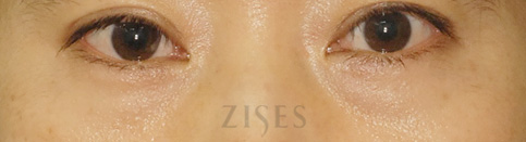 ���� ���� ����