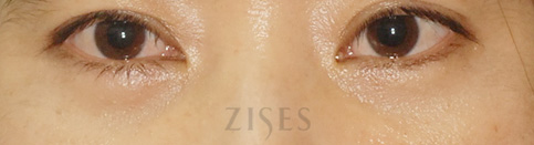 ���� ���� ����