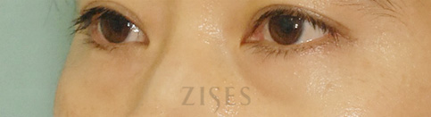 ���� ���� ����