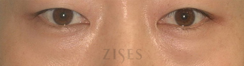 ���� ���� ����