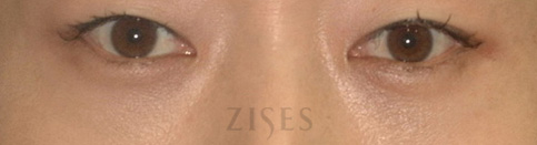 ���� ���� ����