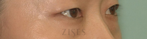 ���� ���� ����