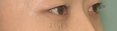 ���� ���� ����