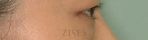 ���� ���� ����