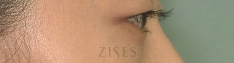 ���� ���� ����