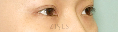 ���� ���� ����