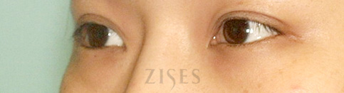 ���� ���� ����