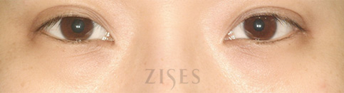 ���� ���� ����