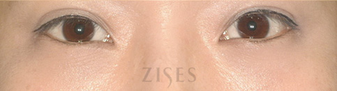 ���� ���� ����