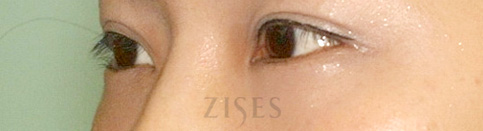 ���� ���� ����