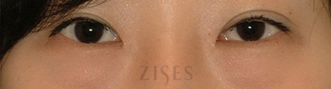 ���� ���� ����