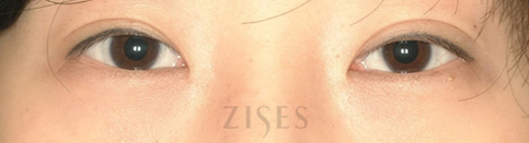 ���� ���� ����