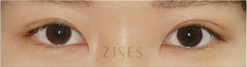 �� ���� ���� ����