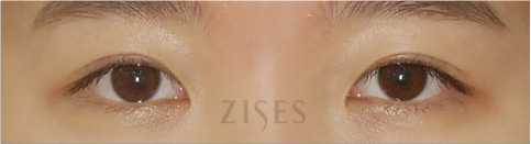 �� ���� ���� ����