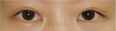 �� ���� ���� ����