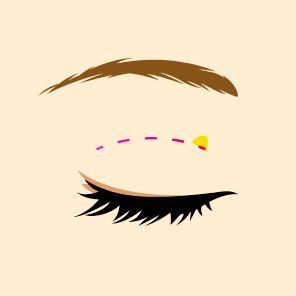 �κ� ������ ���� ����