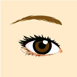 ��Ʈ�� ���� ����