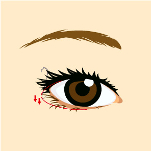 ��Ʈ�� ���� ����